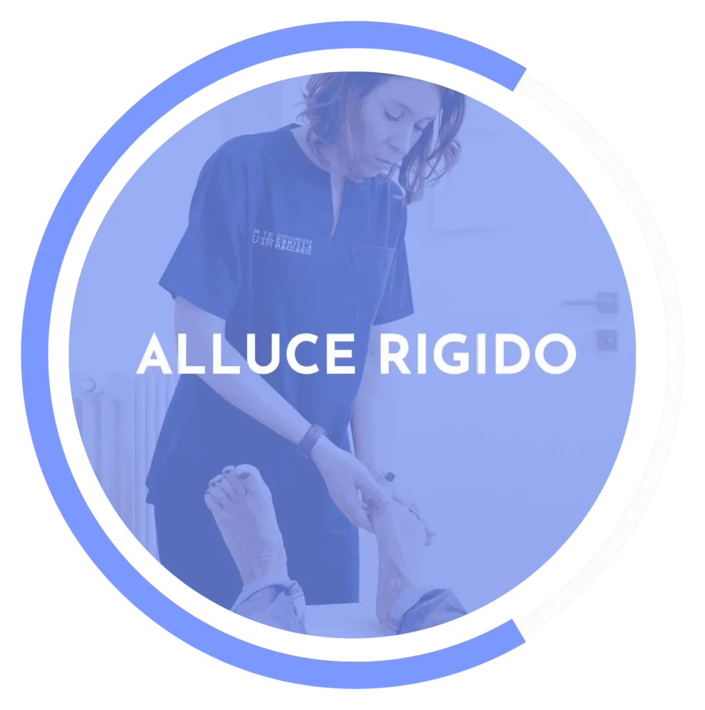 Alluce rigido