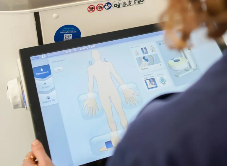 neuroma di Morton cura